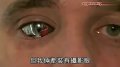 真版生化人 电眼男微型摄影机装入眼部