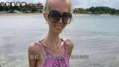 世界上最瘦的女人,身高1米58体重20千克,行走的活骷髅